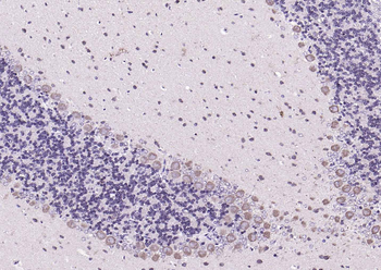 Phospho-PYK2 (Tyr402) Rabbit P