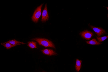 Mutant p53 (N235K, N239Y) Rabb