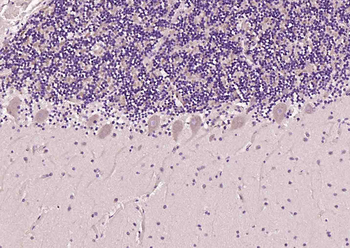 Mu Opioid receptor Rabbit Poly