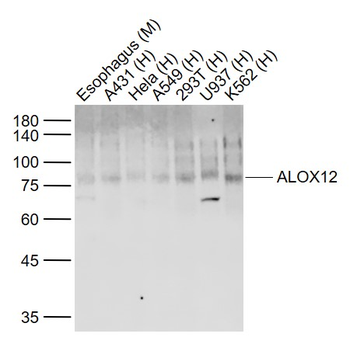 ALOX12 Rabbit Polyclonal Antib