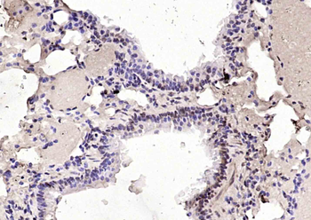 RFC1 Rabbit Polyclonal Antibod