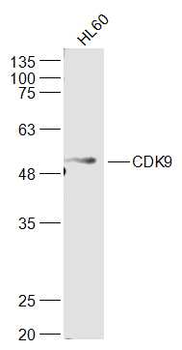 CDK9 Rabbit Polyclonal Antibod