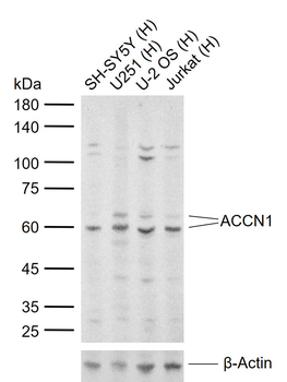 ACCN1 Rabbit Polyclonal Antibo