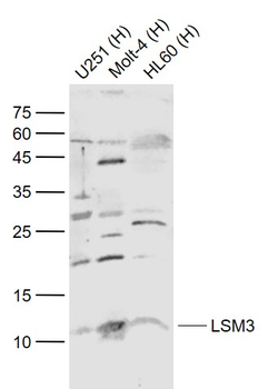 LSM3 Rabbit Polyclonal Antibod