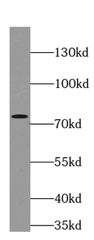 FUS Antibody抗体,orb395058,biorb