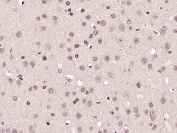 Phospho-PRKCB (Thr642) Rabbit 