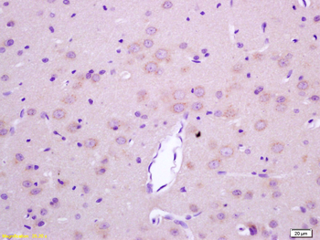 LGI1 Rabbit Polyclonal Antibod