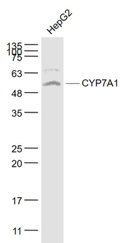 CYP7A1 Rabbit Polyclonal Antib