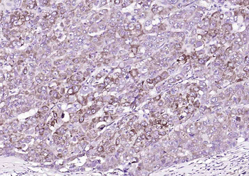 SGPL1 Rabbit Polyclonal Antibo