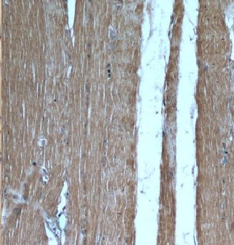 CAMK2G Antibody抗体，orb394833，bi