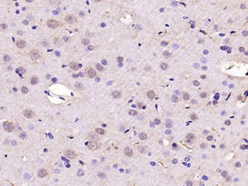 SREBP1 Rabbit Polyclonal Antib