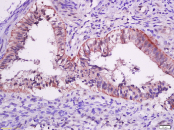 Mutant p53 (N235K, N239Y) Rabb