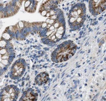 Lin28A Antibody抗体，orb395271，bi