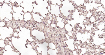 PSME3 Rabbit Polyclonal Antibo