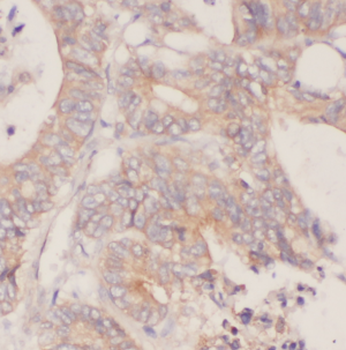 CDC37 Antibody抗体,orb625652,bio