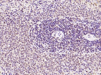 Phospho-PRKCB (Thr642) Rabbit 