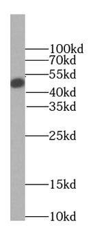 GLA Antibody抗体,orb394692,biorb