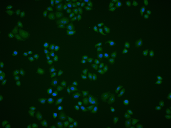 PDCD4 Rabbit Polyclonal Antibo