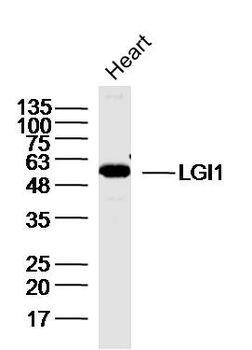 LGI1 Rabbit Polyclonal Antibod