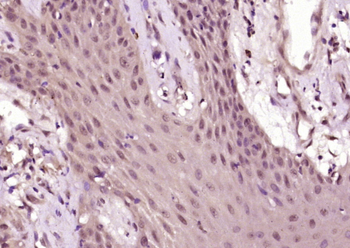 Phospho-Akt (Thr450) Rabbit Po