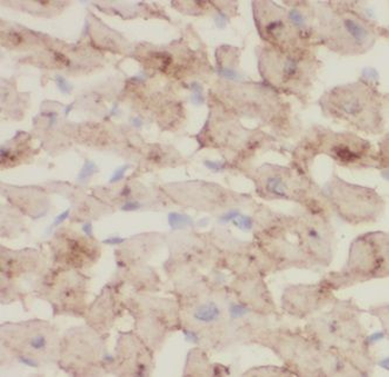 ITPA Antibody抗体,orb628148,bior