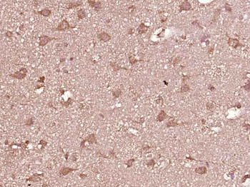 MMP12 Rabbit Polyclonal Antibo