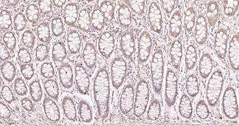 BARD1 Rabbit Polyclonal Antibo
