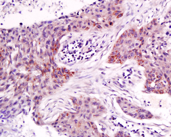 NAP2 Rabbit Polyclonal Antibod