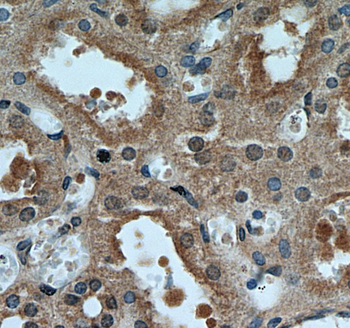 CDKN1A Antibody抗体，orb395396，bi