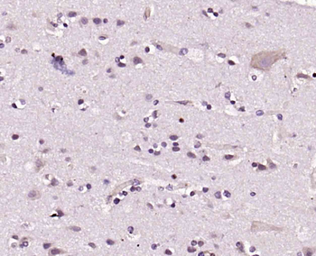 CLK2 Rabbit Polyclonal Antibod