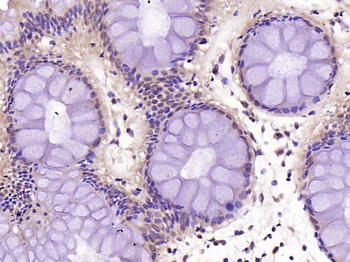 NFKB p65 Rabbit Polyclonal Ant