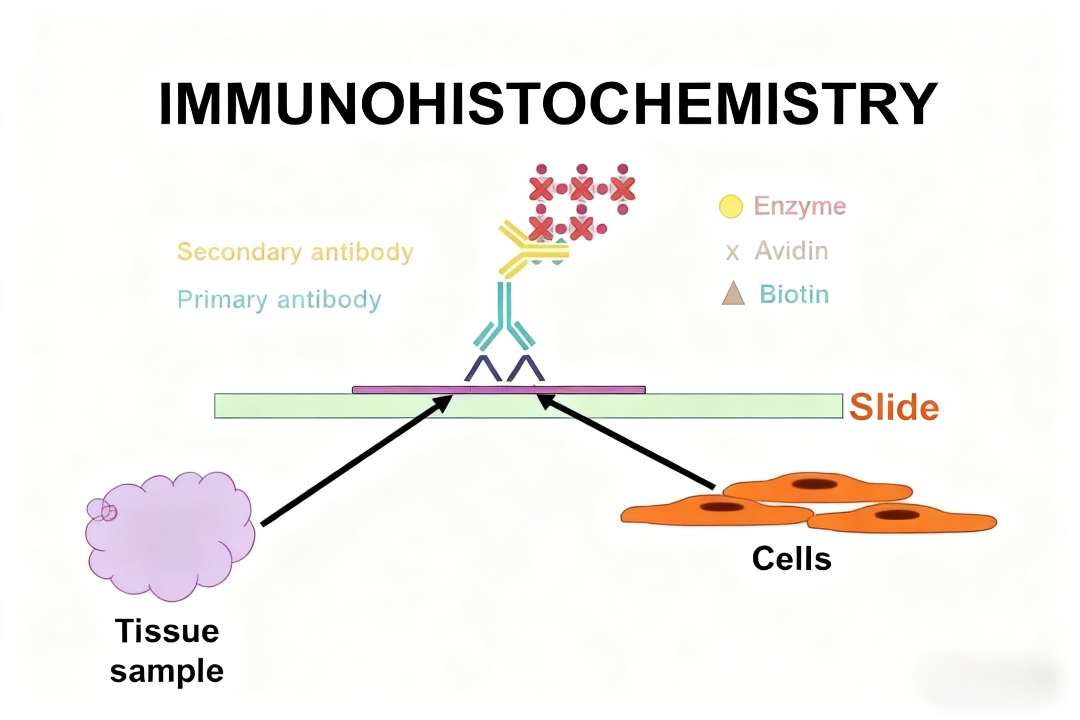 免疫组化数据处理如何实现生物标志物的精准量化？