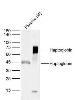 Haptoglobin Rabbit Polyclonal 