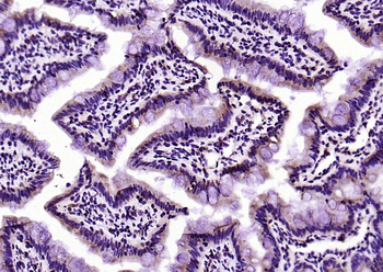 SLC15A1 Rabbit Polyclonal Anti