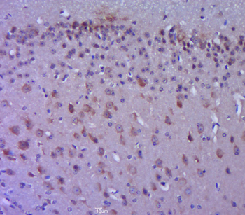 Phospho-FAK (Tyr861) Rabbit Po