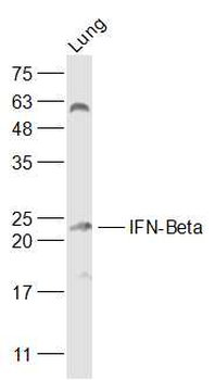 IFNB1 Rabbit Polyclonal Antibo