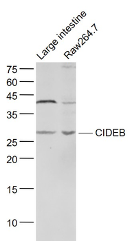 CIDEB Rabbit Polyclonal Antibo
