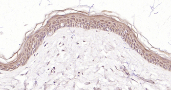 BARD1 Rabbit Polyclonal Antibo