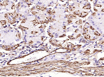 Alpha smooth muscle Actin Reco