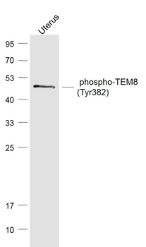 Phospho-TEM8 (Tyr382) Rabbit P