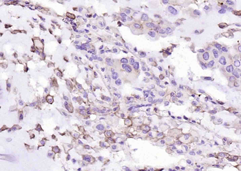 PD-L1 Recombinant Rabbit Monoc