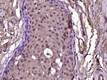 A Raf Rabbit Polyclonal Antibo