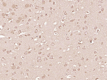 Beta-arrestin 2 Rabbit Polyclo