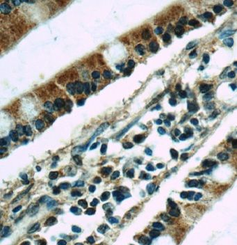 ABCC2 Antibody抗体,orb628927,bio