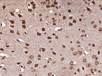 Ferritin Heavy Chain/FTH1 Rabb