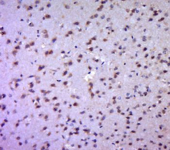 Aldolase A Rabbit Polyclonal A