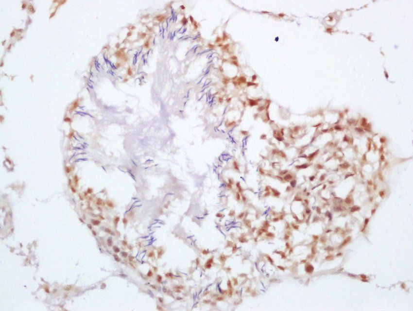 SRD5A2 Rabbit Polyclonal Antib