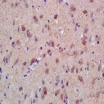 Menin Rabbit Polyclonal Antibo