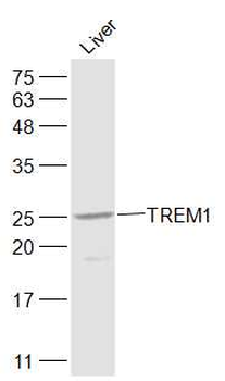 TREM1 Rabbit Polyclonal Antibo