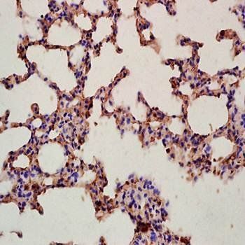 Integrin alpha 4+Beta 7 Rabbit